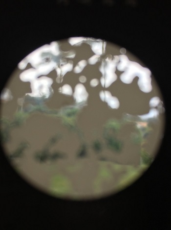 Shows simulation of patch vision loss
